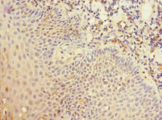 Polyclonal Rabbit anti-Human CR1 / CD35 Antibody (aa420-550, IHC, WB)