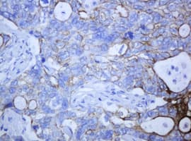 KRT5 / CK5 / Cytokeratin 5 Antibody (aa1-273, clone OTI1E7)
