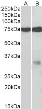 IHC-plus™ Polyclonal Goat anti-Human GPM6A / Glycoprotein M6A Antibody (aa59-70, IHC, WB)