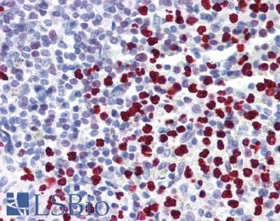 IHC-plus™ MNDA Antibody (aa37-321, clone 4H6)