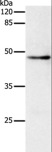 Polyclonal Rabbit anti-Human DRD1 / Dopamine Receptor D1 Antibody (WB)