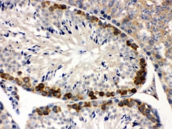 Polyclonal Rabbit anti-Human YBX1 / YB1 Antibody (IHC, WB)