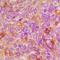 RAF1 / RAF Antibody (C-Terminus)
