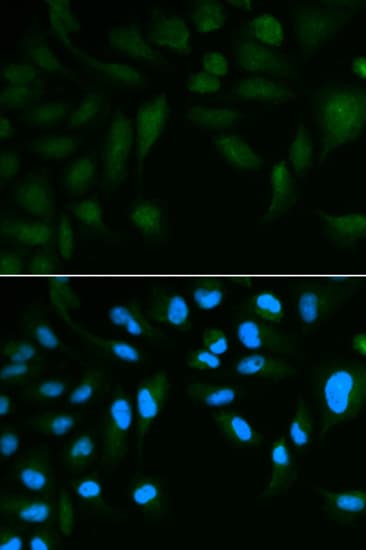 Polyclonal Rabbit anti-Human SPINLW1 / EPPIN Antibody (IHC, IF, WB)