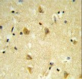 Polyclonal Rabbit anti-Human MPV17 Antibody (aa24-50, IHC, WB)