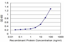 Monoclonal Mouse anti-Human IL12RB2 Antibody (clone 2H6, WB)