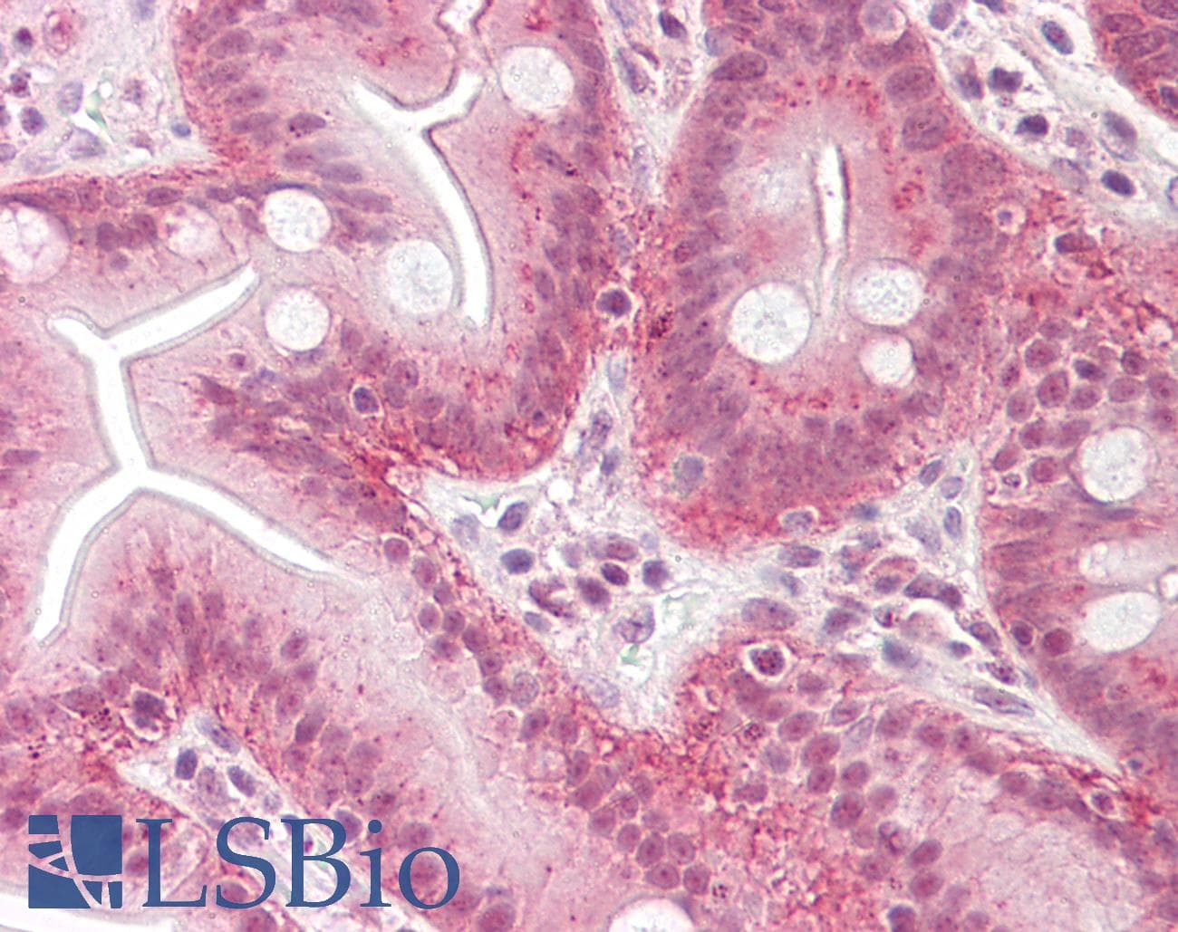 IHC-plus™ GCNT3 Antibody (aa226-275)