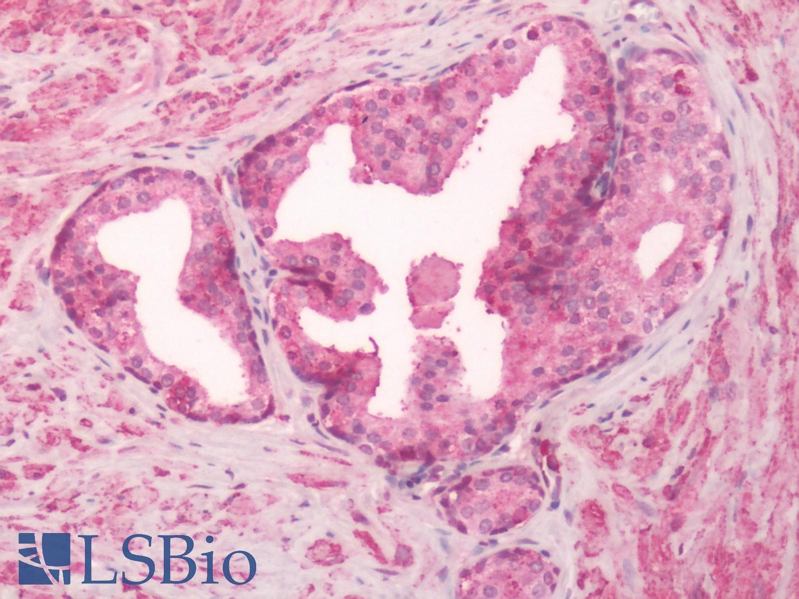PathPlus™ Polyclonal Rabbit anti-Human GPR55 Antibody (Extracellular Domain, IHC)