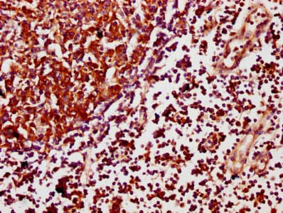Polyclonal Rabbit anti-Human SCIMP Antibody (IHC, IF)
