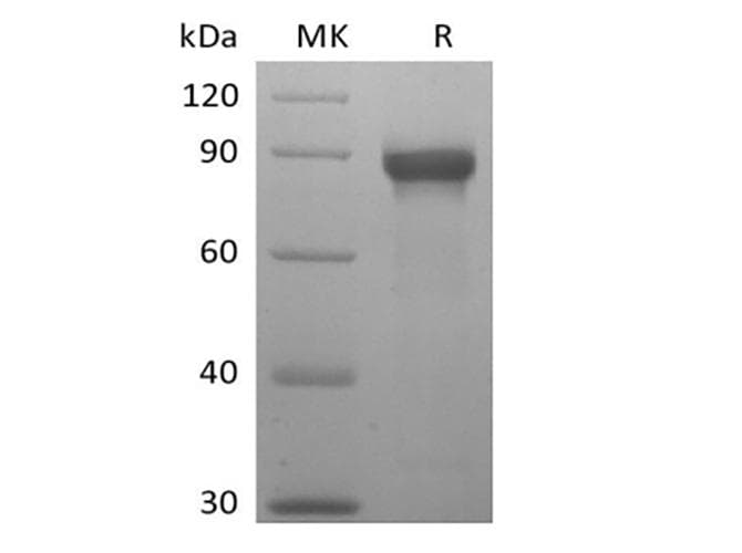 Human SIGLEC8 Protein (Recombinant Mouse IgG Fc, C-terminus)