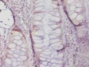 MGMT Antibody