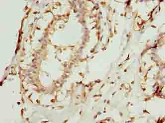 Polyclonal Rabbit anti-Human COA1 Antibody (IHC)