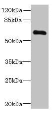 Polyclonal Rabbit anti-Human PPP2R1B Antibody (IHC, WB)