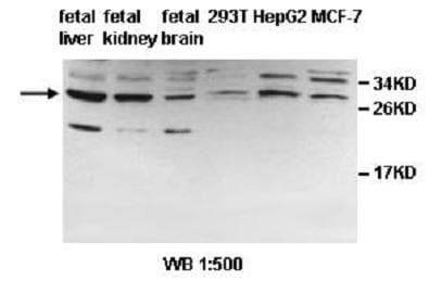IHC-plus™ PDCL2 Antibody (aa5-237)