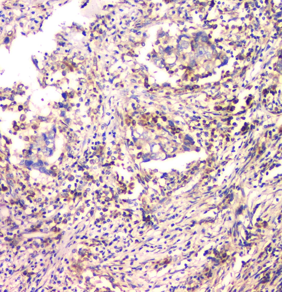 IFN Gamma / Interferon Gamma Antibody