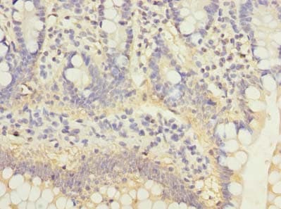 C5orf22 Antibody