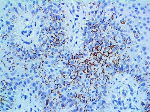 Treponema pallidum Antibody