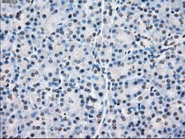 CYPOR / POR Antibody (clone OTI4G2)