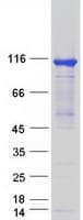 Human HKDC1 Protein (Recombinant Myc-DDK (Flag))