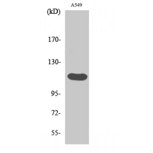 FGFR2 / FGF Receptor 2 Antibody (440-520 aa, Internal)