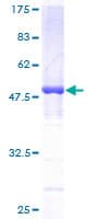Human DCTN1 / Dynactin 1 Protein (Recombinant GST)
