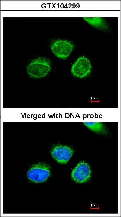 AKR7A2 / AFAR Antibody (aa84-359)
