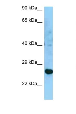 HLA-DRB3 Antibody (aa150-199)