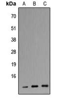 APOC3 / Apolipoprotein C III Antibody (C-Terminus)