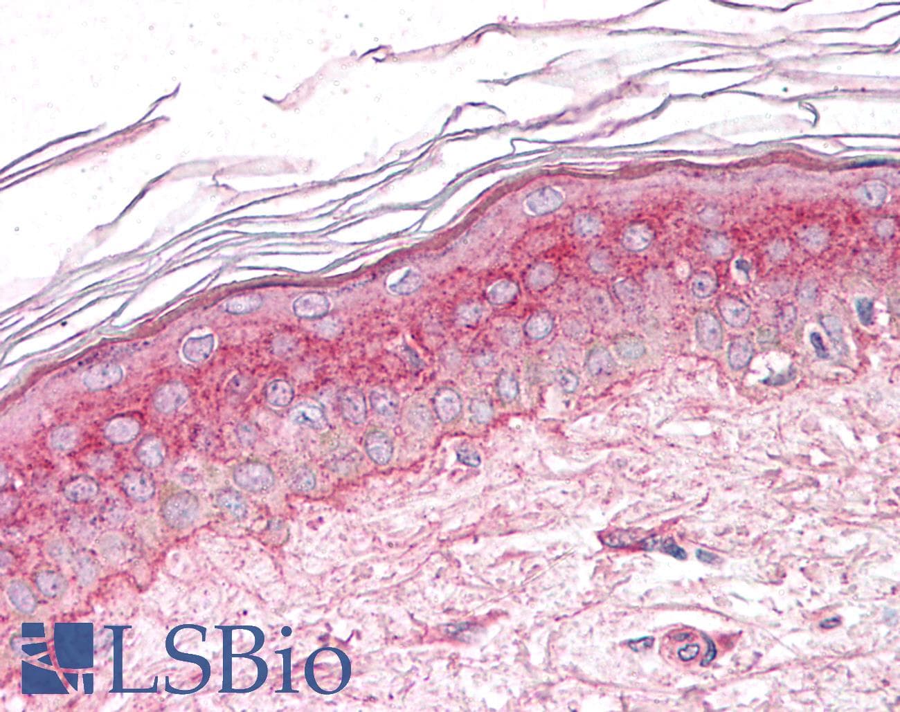 IHC-plus™ Polyclonal Rabbit anti-Human GM2A Antibody (C-Terminus, IHC)