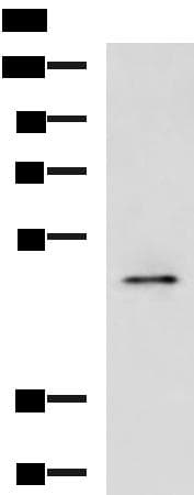 PDK4 Antibody
