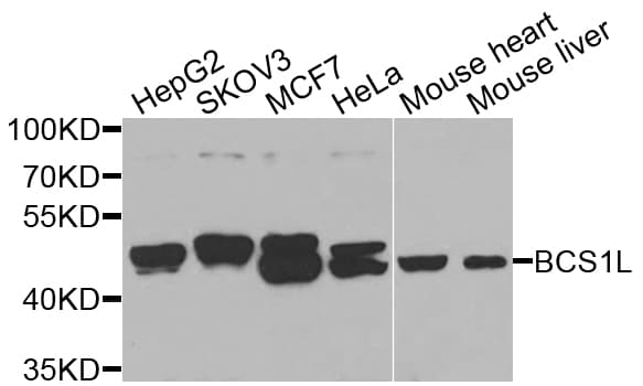 BCS1L Antibody
