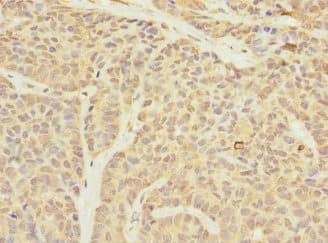 TIM23 Antibody