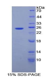 Human ADH1A / Alcohol Dehydrogenase Protein (Recombinant His-T7)