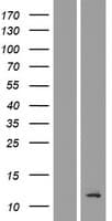 TMEM196 Protein (Over-Expression Lysate Myc-DDK (Flag))