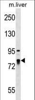 LARP4 Antibody (aa689-717)