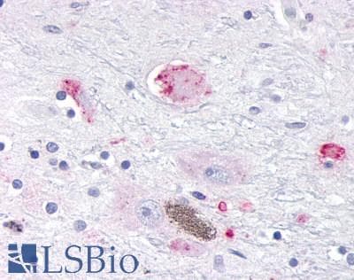 PathPlus™ OR10R2 Antibody (C-Terminus)