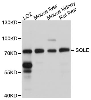 Polyclonal Rabbit anti-Human ERG1 / SQLE Antibody (IHC, WB)