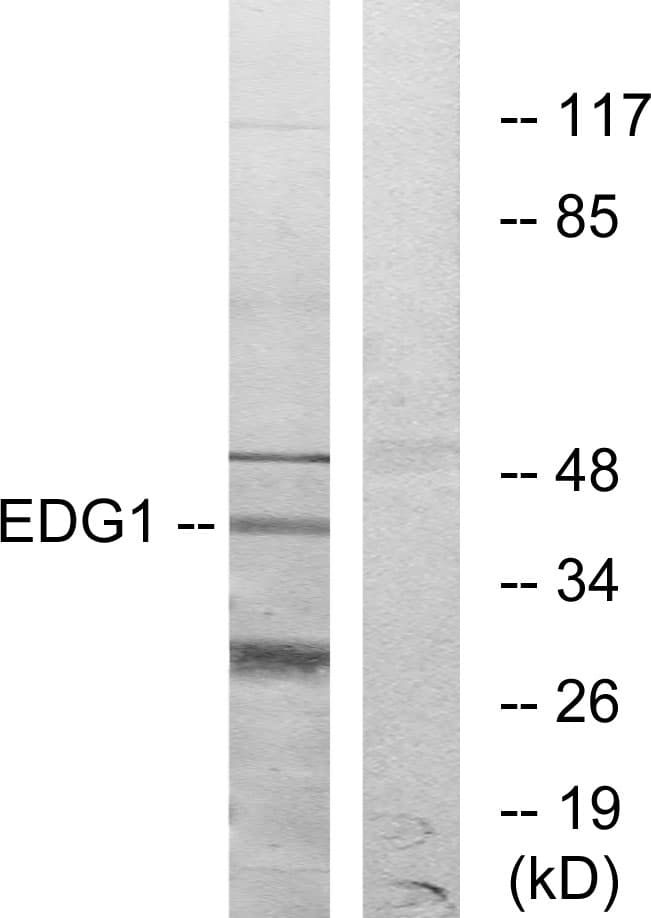 S1PR1 / EDG1 / S1P1 Antibody (aa5-54)