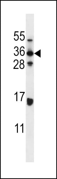 HELO1 / ELOVL5 Antibody (aa240-269)