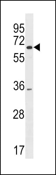 Polyclonal Rabbit anti-Human SRRM3 Antibody (aa264-291, WB)