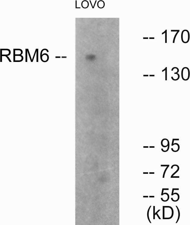 RBM6 / 3G2 Antibody