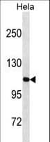 IHC-plus™ Polyclonal Rabbit anti-Human LONP1 / LON Antibody (aa389-418, IHC, WB)