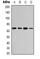 RELA / NFKB p65 Antibody (Acetyl-Lys218)