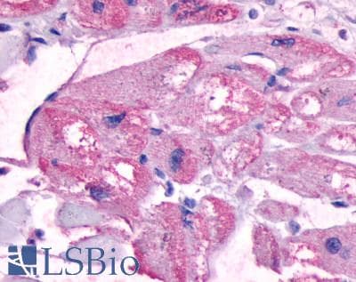 PathPlus™ Polyclonal Rabbit anti-Human B1R / BDKRB1 Antibody (C-Terminus, IHC)