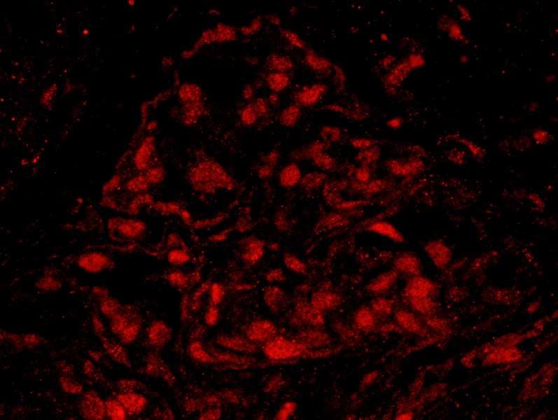 BRCA1 Antibody (aa700-750)