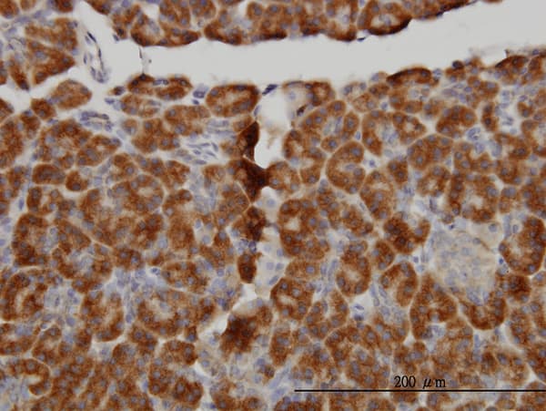 MTM1 / Myotubularin Antibody (clone 1C10)