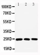 RAB11A Antibody (aa194-211)