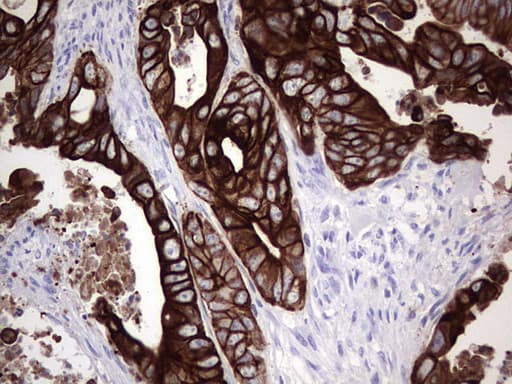 Monoclonal Mouse anti-Human KRT19 / CK19 / Cytokeratin 19 Antibody (clone OTI5H6, aa240-390, IHC, WB)
