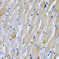 GARS / Glycyl tRNA Synthetase Antibody