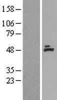 Human MCAD / ACADM Protein (Over-Expression Lysate Myc-DDK (Flag))
